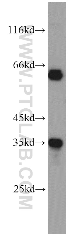 WB analysis of HeLa using 10439-1-AP