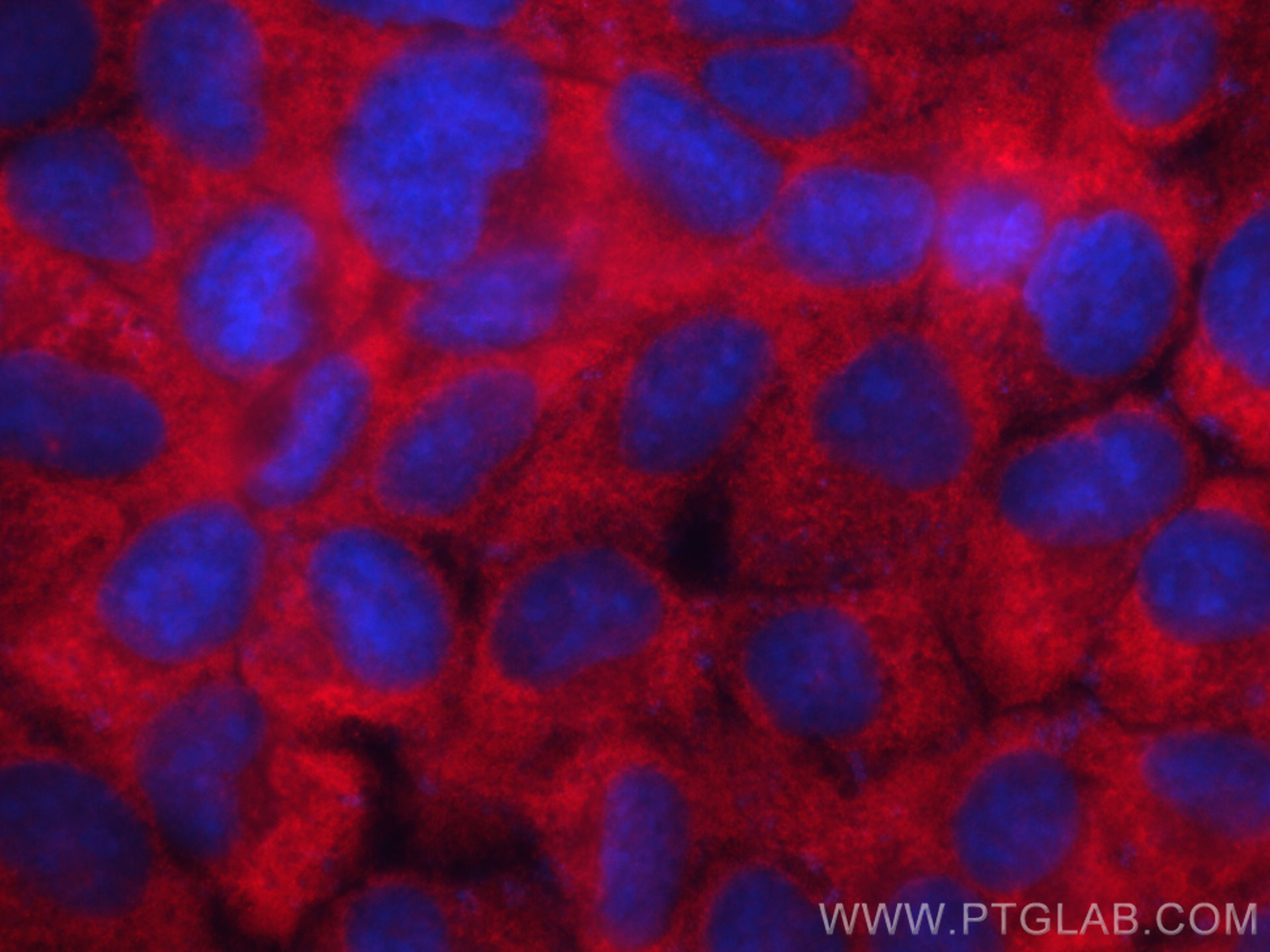 IF Staining of A431 using 11423-1-AP