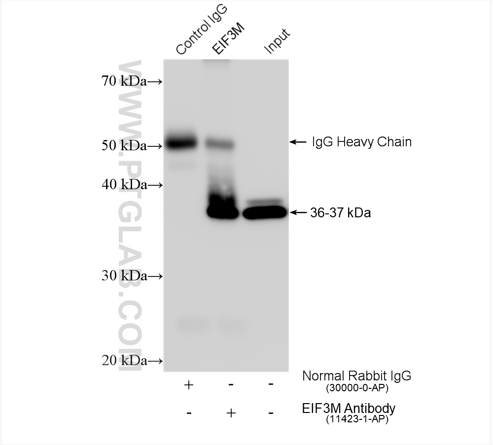 IP experiment of HeLa using 11423-1-AP