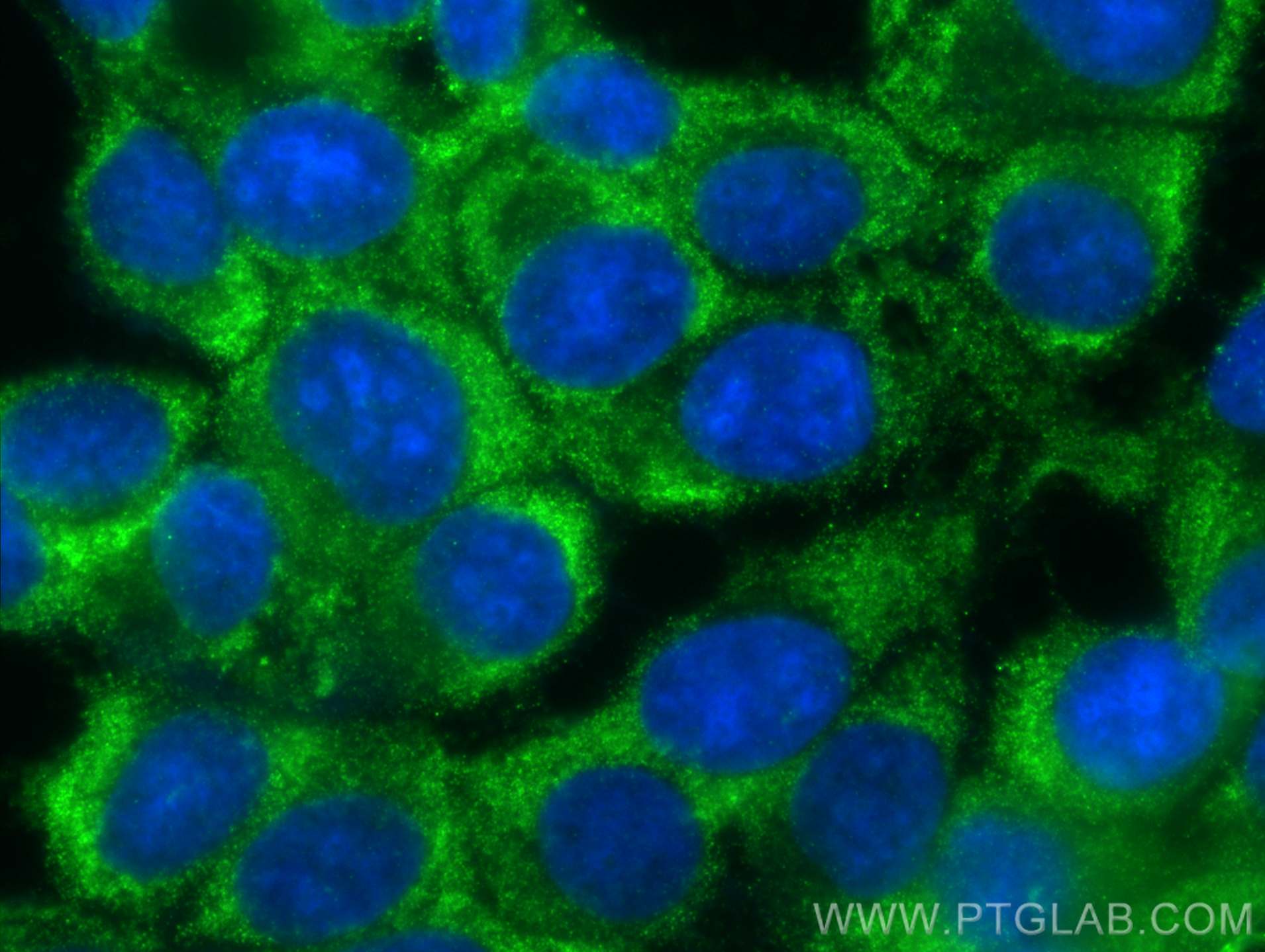 IF Staining of MCF-7 using 66025-1-Ig