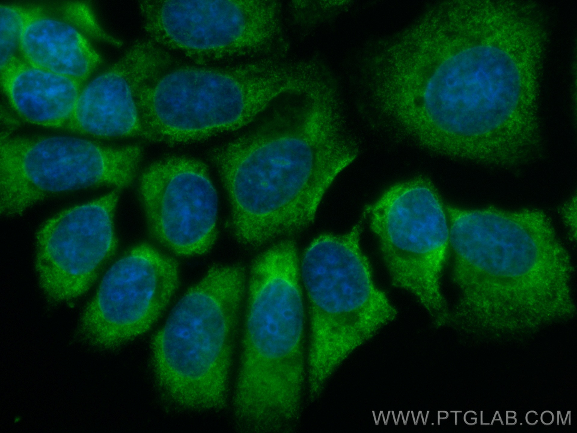 IF Staining of MCF-7 using CL488-66025