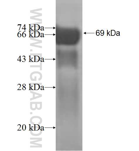 EIF3M fusion protein Ag1994 SDS-PAGE