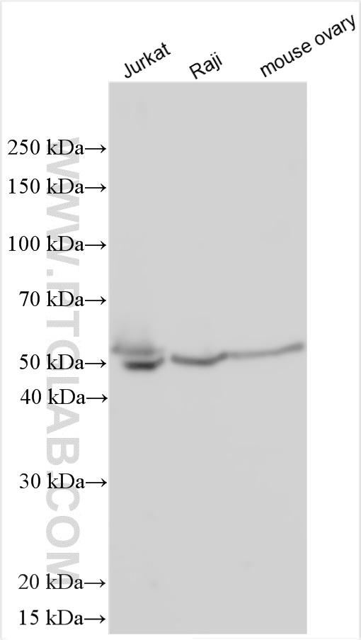 Various lysates were subjected to SDS PAGE followed by western blot with 11280-1-AP (EIF4A2 antibody) at dilution of 1:2000 incubated at room temperature for 1.5 hours. WB analysis using 11280-1-AP