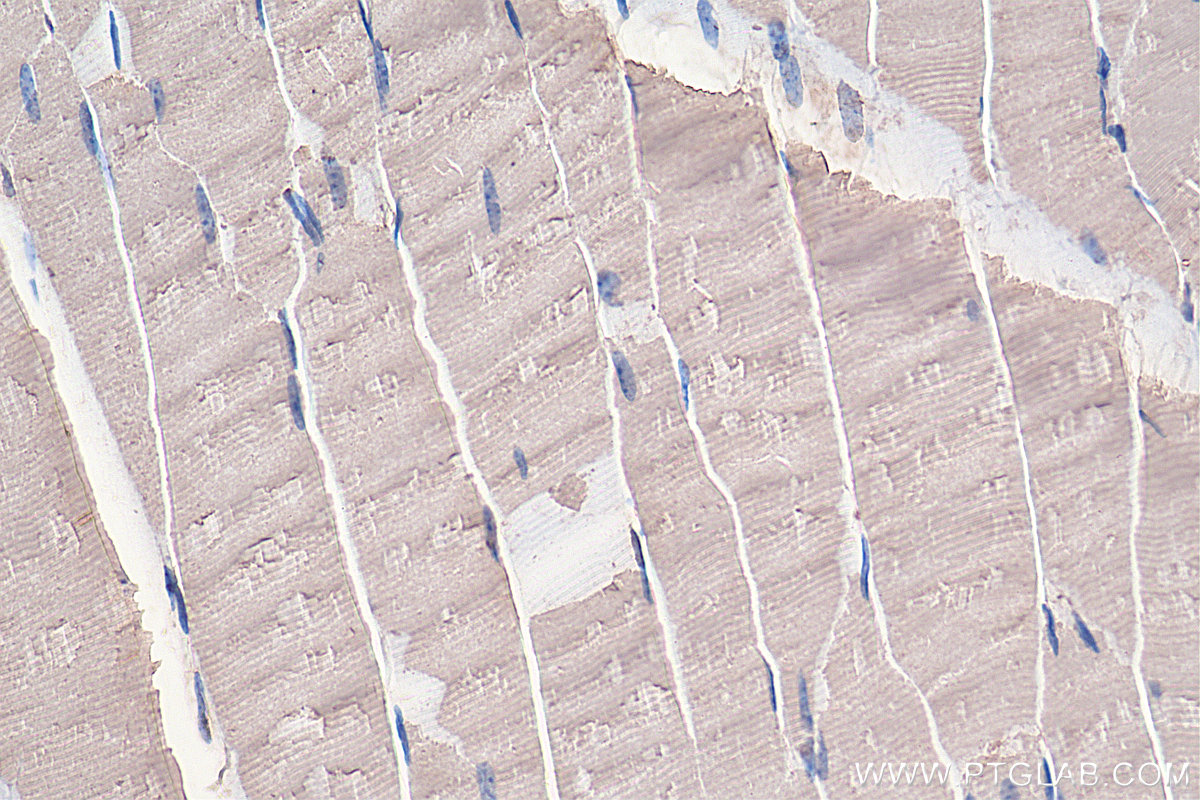 IHC staining of mouse skeletal muscle using 16119-1-AP