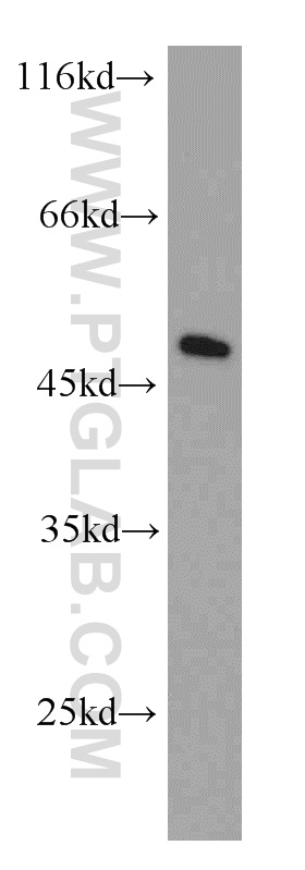 WB analysis of HeLa using 10463-1-AP