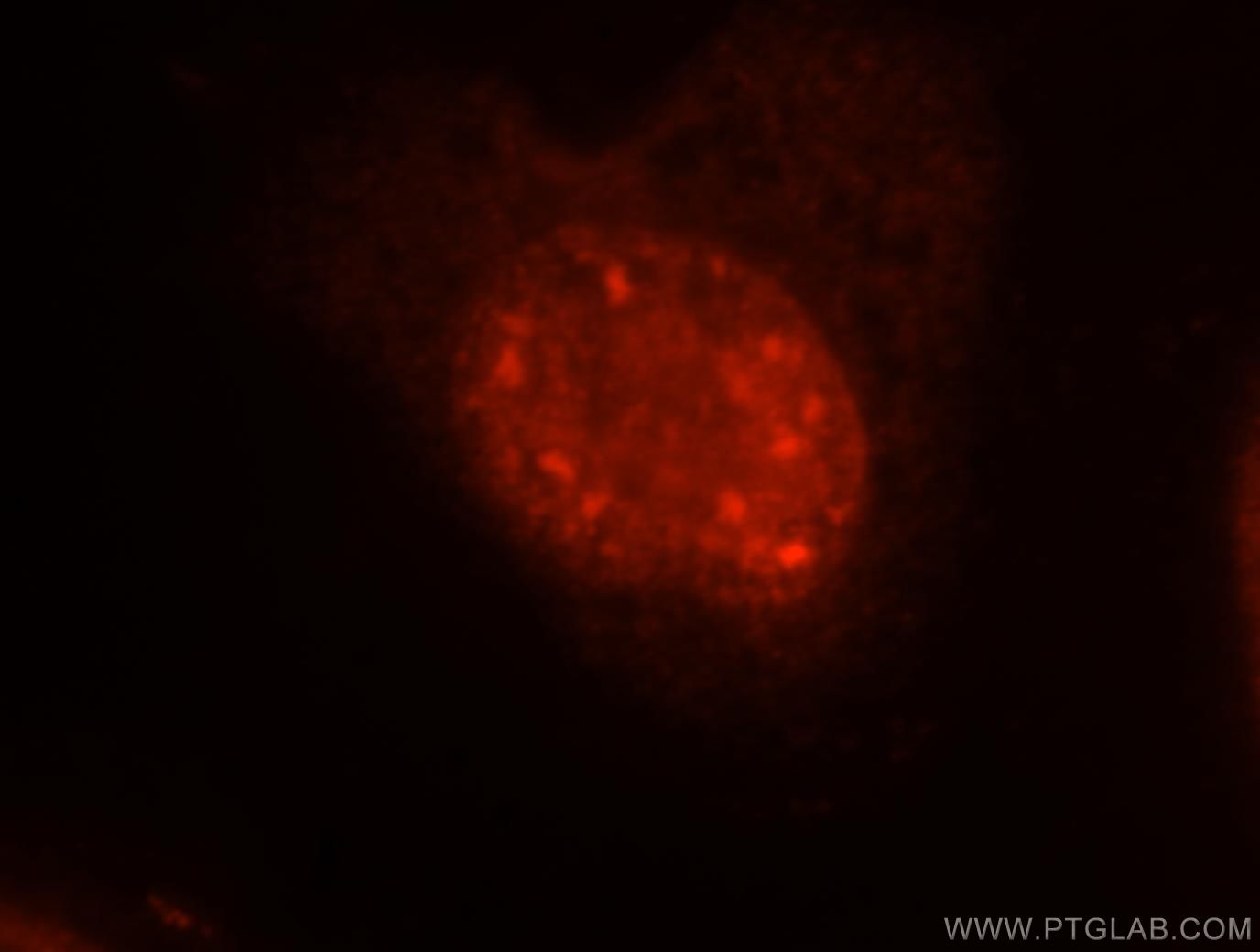 IF Staining of MCF-7 using 17504-1-AP