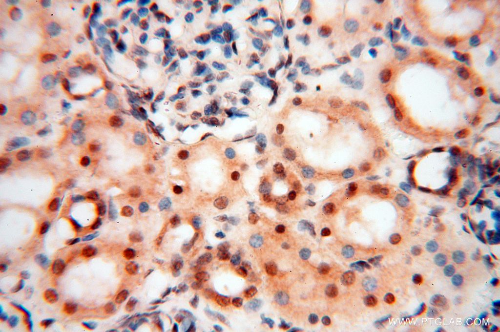 IHC staining of human kidney using 17504-1-AP