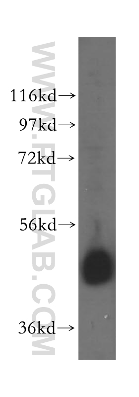 WB analysis of A549 using 17504-1-AP