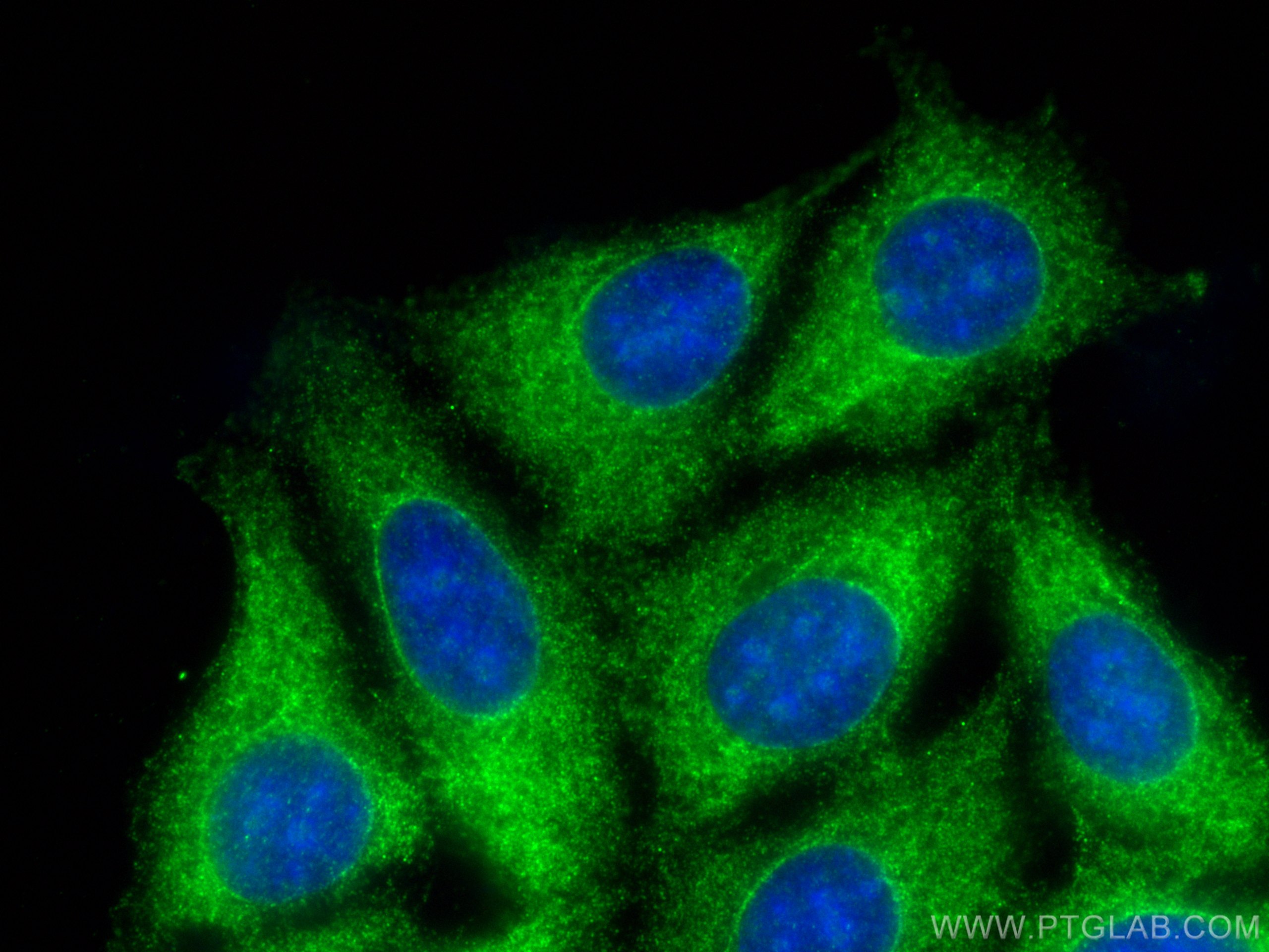 IF Staining of MCF-7 using 17917-1-AP