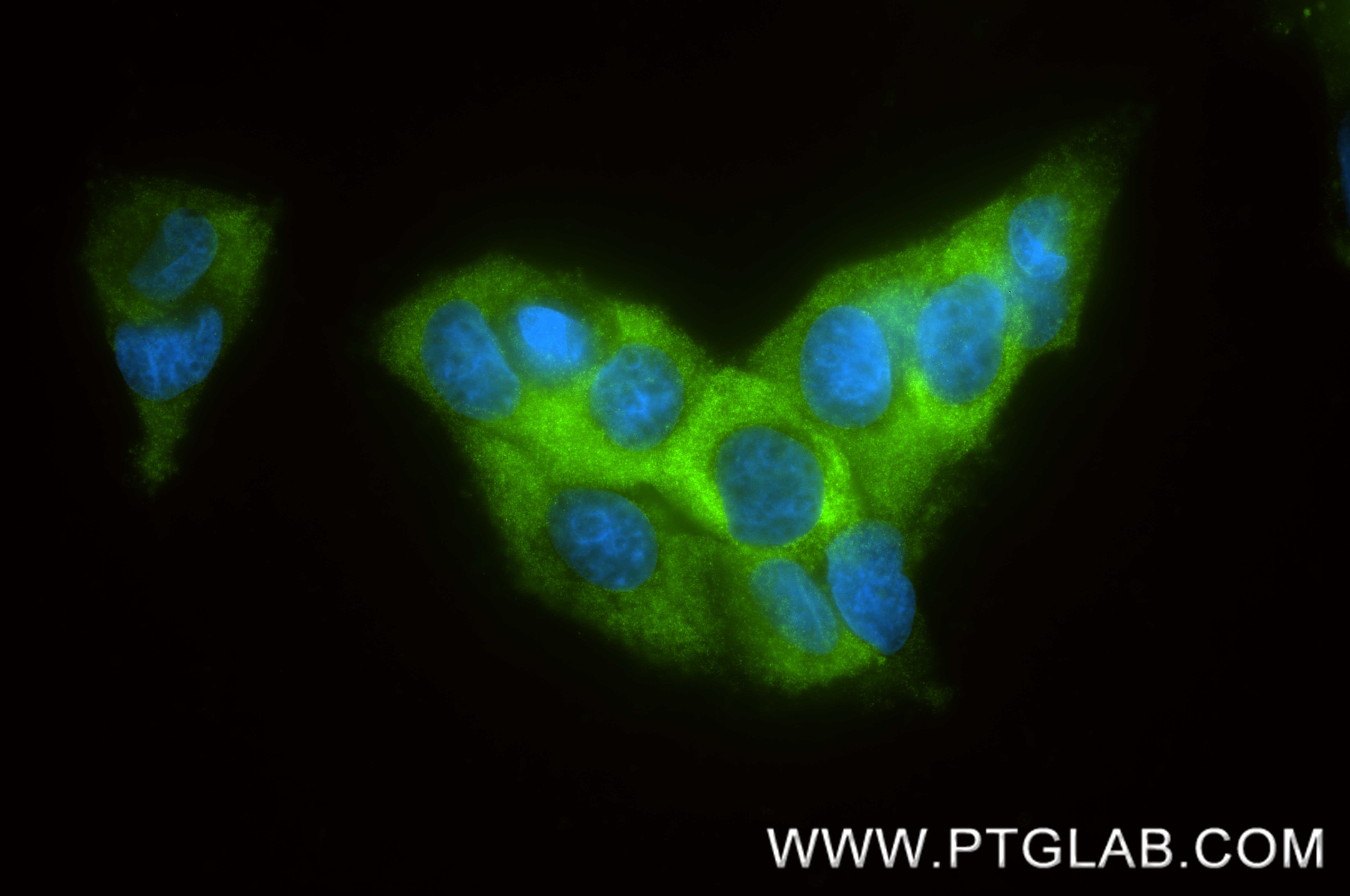 IF Staining of MCF-7 using 88367-1-RR IF Staining of MCF-7 using 88367-1-RR
