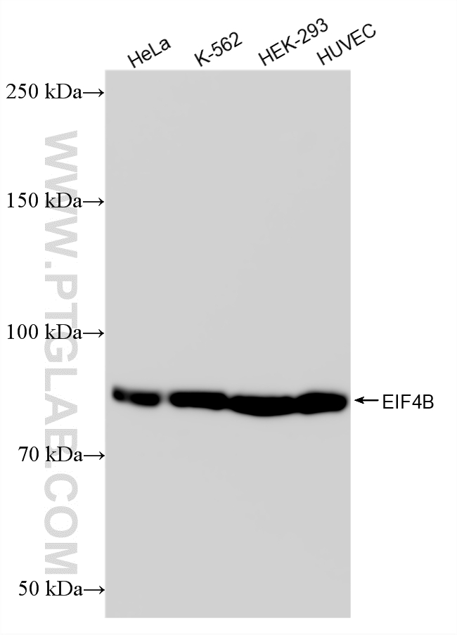 WB analysis using 88367-1-RR WB analysis using 88367-1-RR