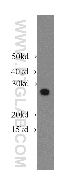 WB analysis of HeLa using 12227-1-AP