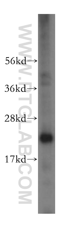 WB analysis of HeLa using 17282-1-AP