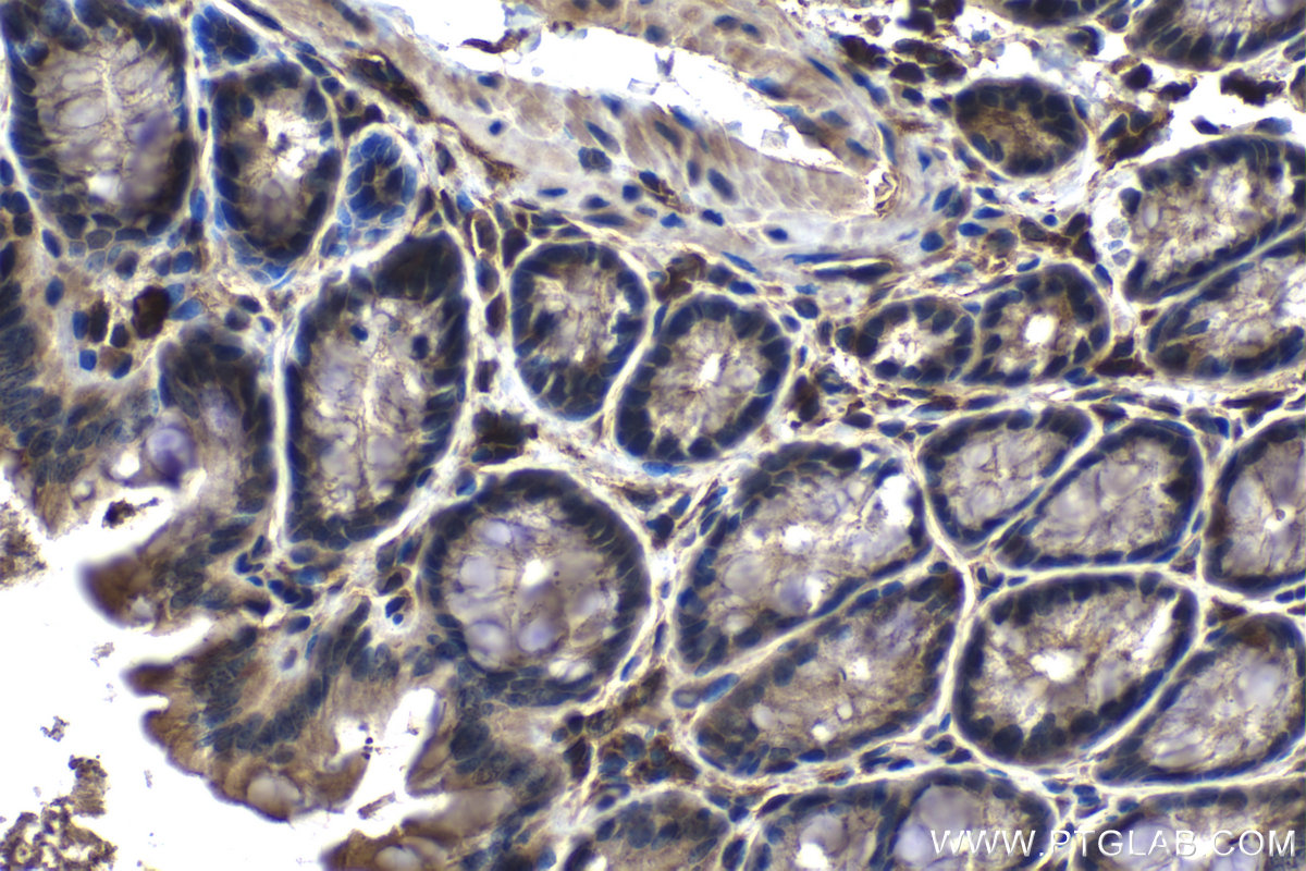 IHC staining of mouse colon using 68171-1-Ig