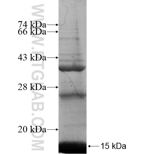 EIF4E3 fusion protein Ag10864 SDS-PAGE EIF4E3 fusion protein Ag10864 SDS-PAGE