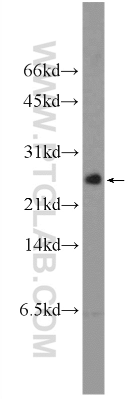 WB analysis of mouse testis using 11182-1-AP