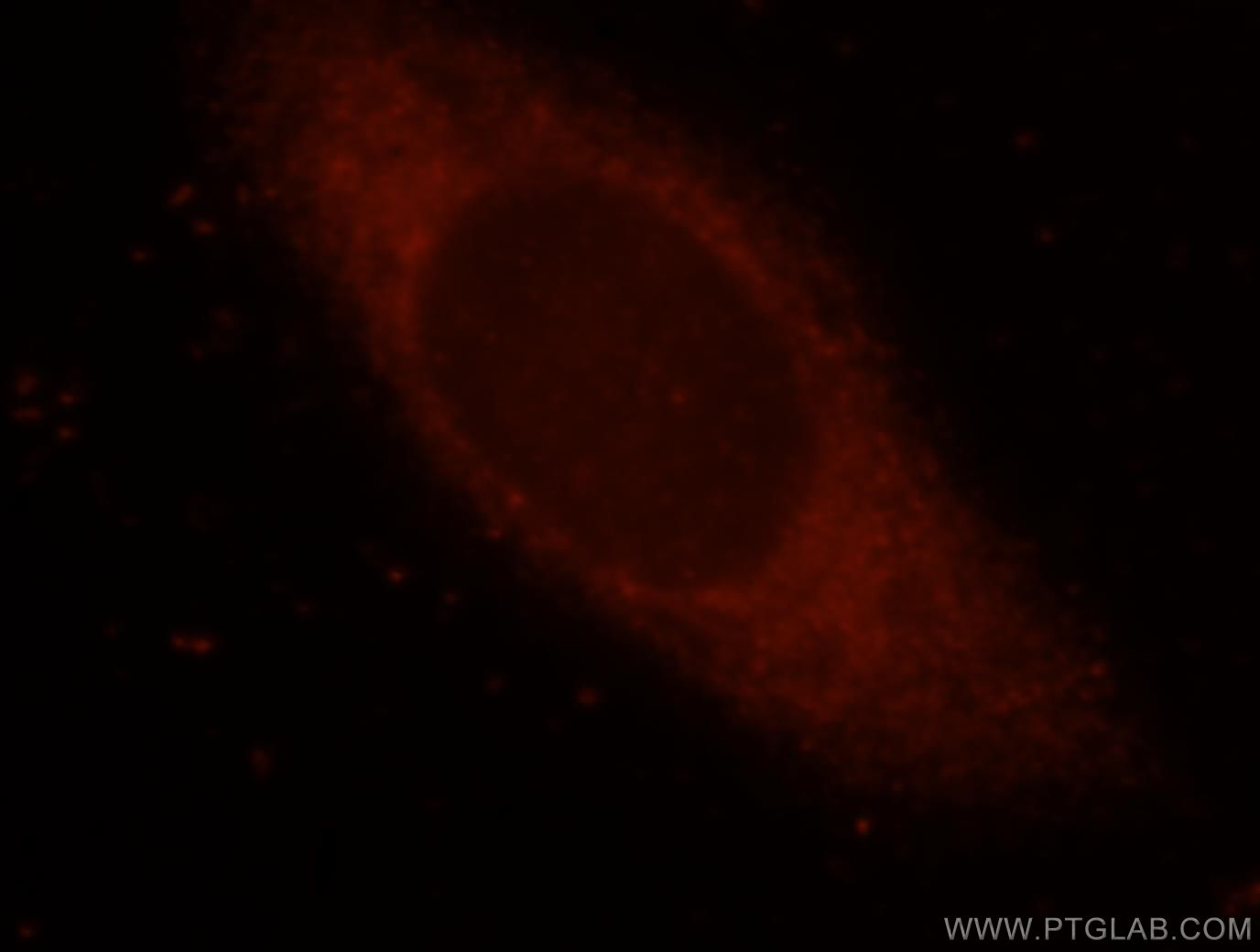 IF Staining of HeLa using 15704-1-AP