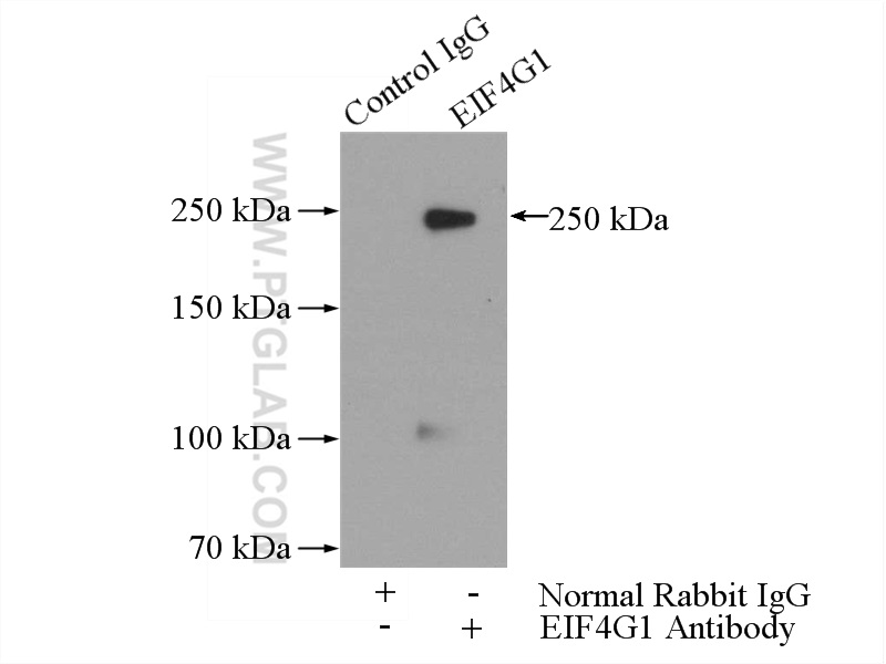 IP experiment of HeLa using 15704-1-AP