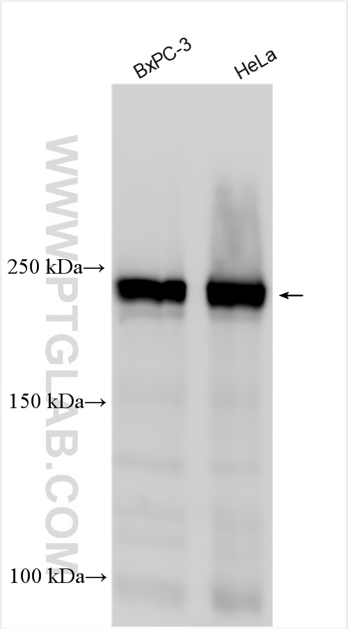 WB analysis using 15704-1-AP