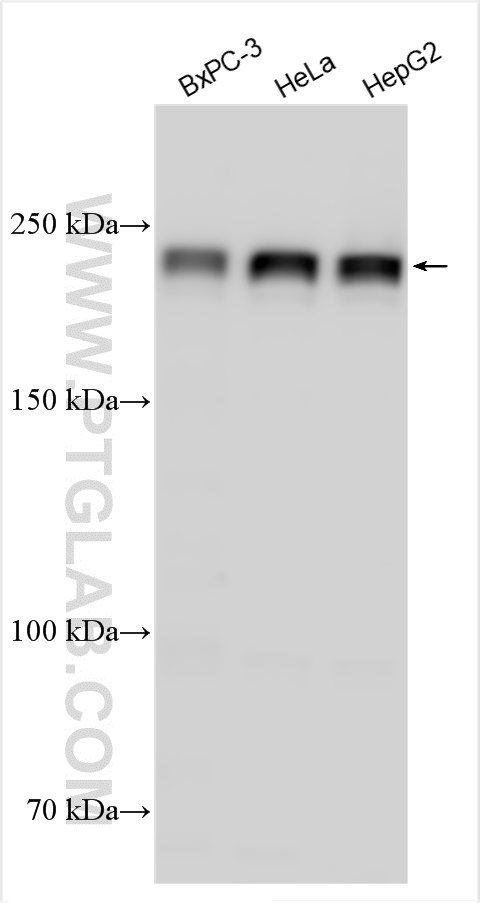 WB analysis using 15704-1-AP