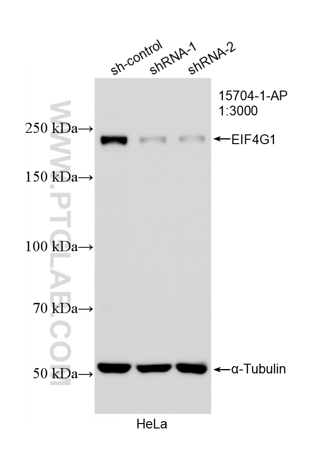 WB analysis of HeLa using 15704-1-AP