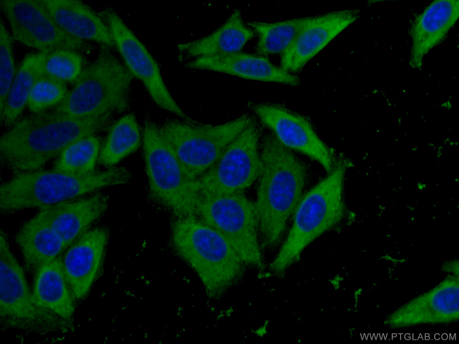 IF Staining of HepG2 using 67199-1-Ig (same clone as 67199-1-PBS)