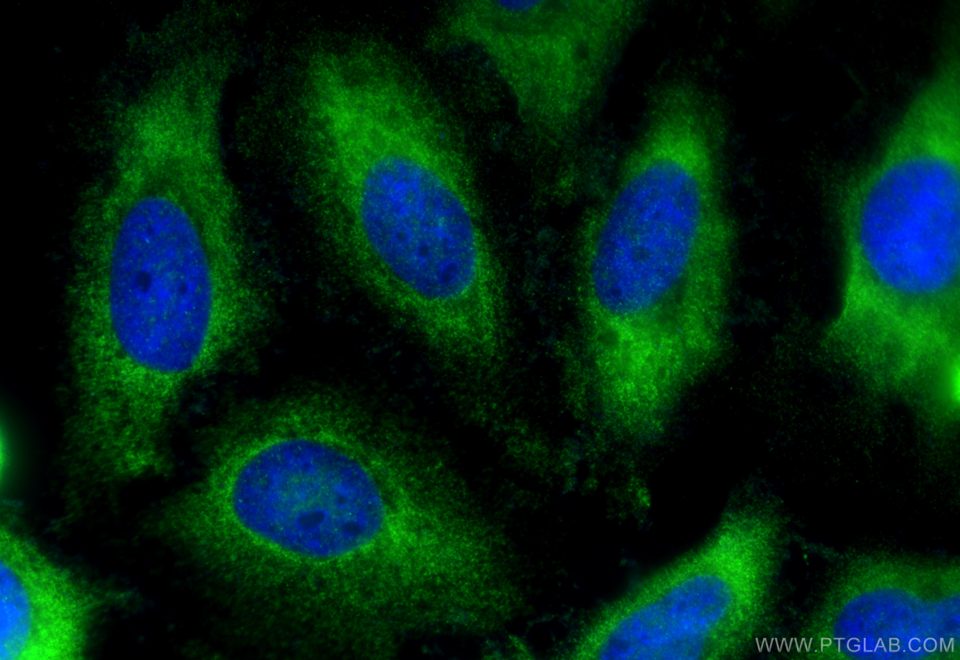 IF Staining of HeLa using 11281-1-AP