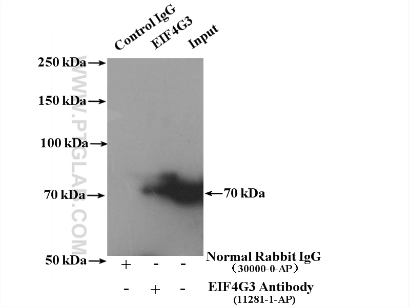 IP experiment of HeLa using 11281-1-AP