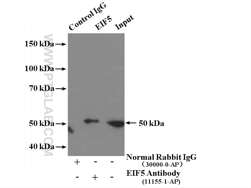 IP experiment of HeLa using 11155-1-AP