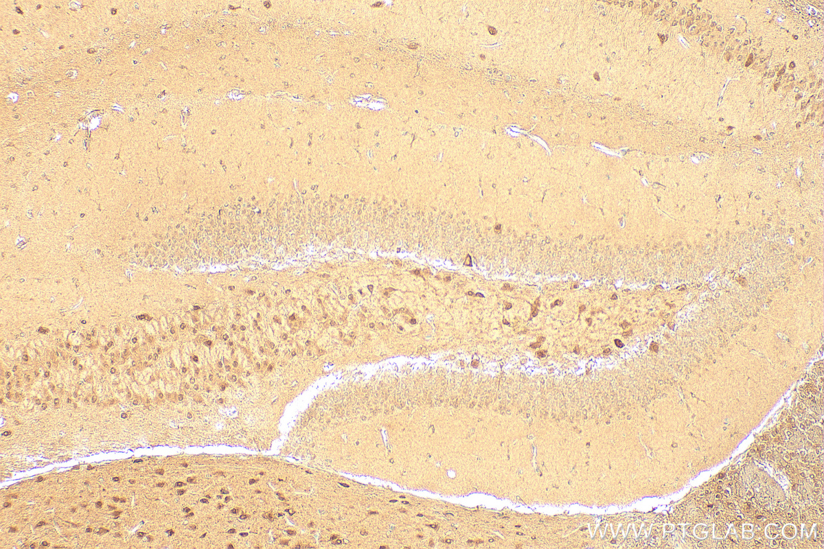 IHC staining of mouse brain using 17069-1-AP