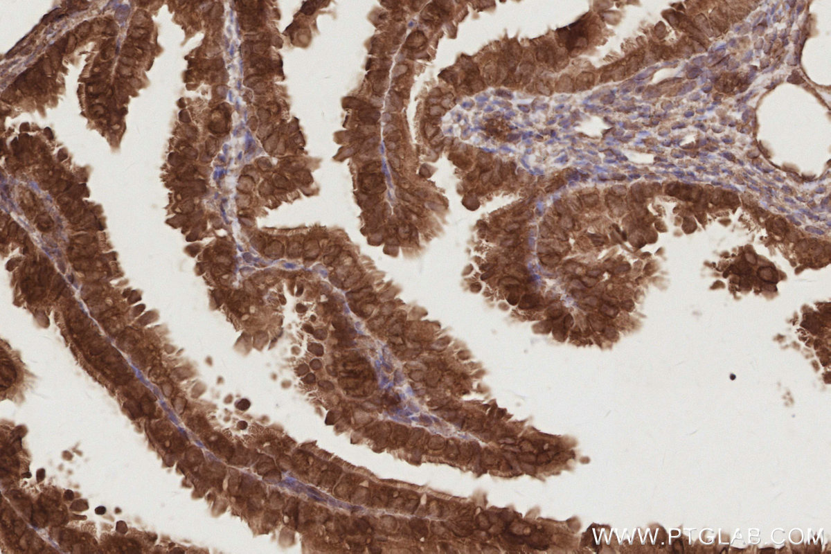 IHC staining of mouse ovary using 17069-1-AP IHC staining of mouse ovary using 17069-1-AP