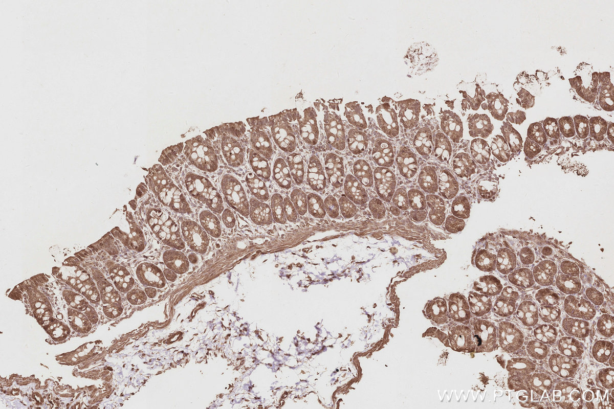 IHC staining of rat colon using 17069-1-AP IHC staining of rat colon using 17069-1-AP