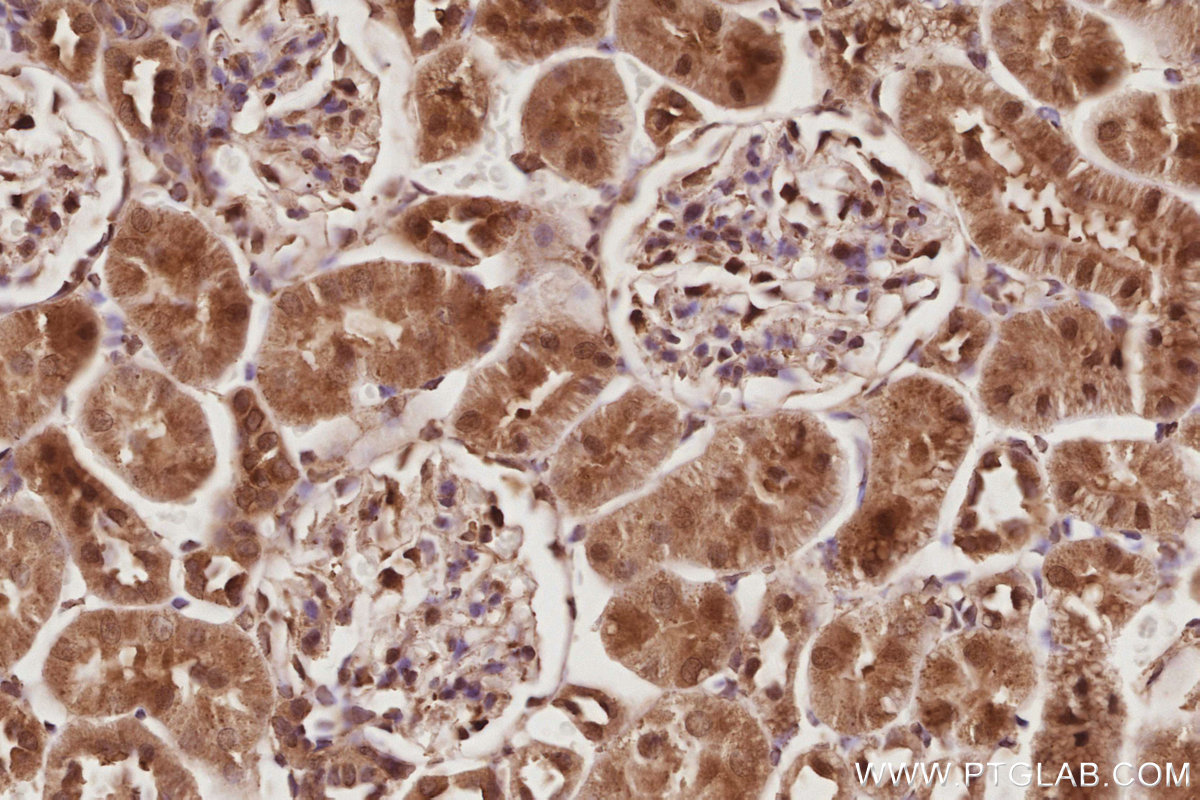 IHC staining of rat kidney using 17069-1-AP IHC staining of rat kidney using 17069-1-AP