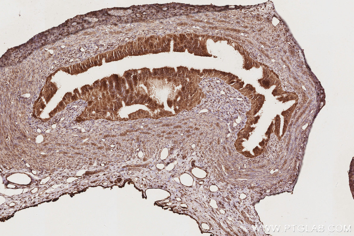 IHC staining of rat ovary using 17069-1-AP IHC staining of rat ovary using 17069-1-AP