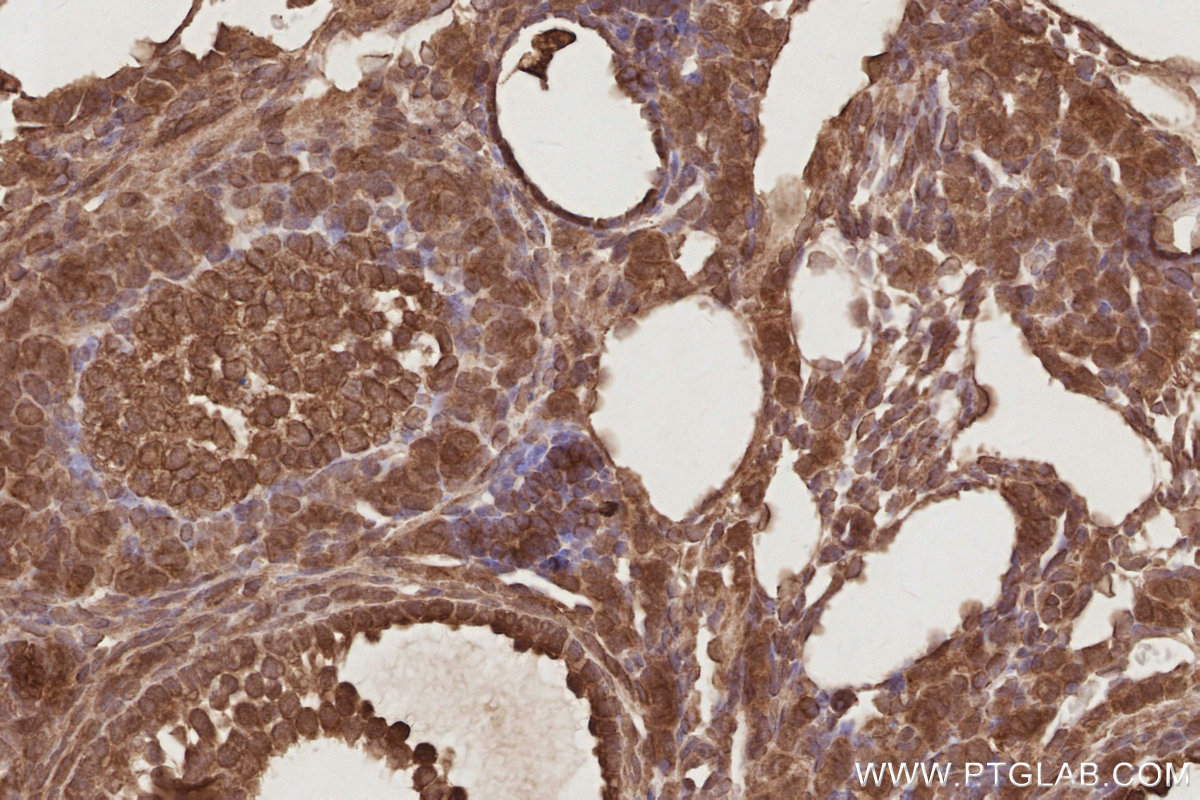 IHC staining of mouse ovary using 17069-1-AP IHC staining of mouse ovary using 17069-1-AP