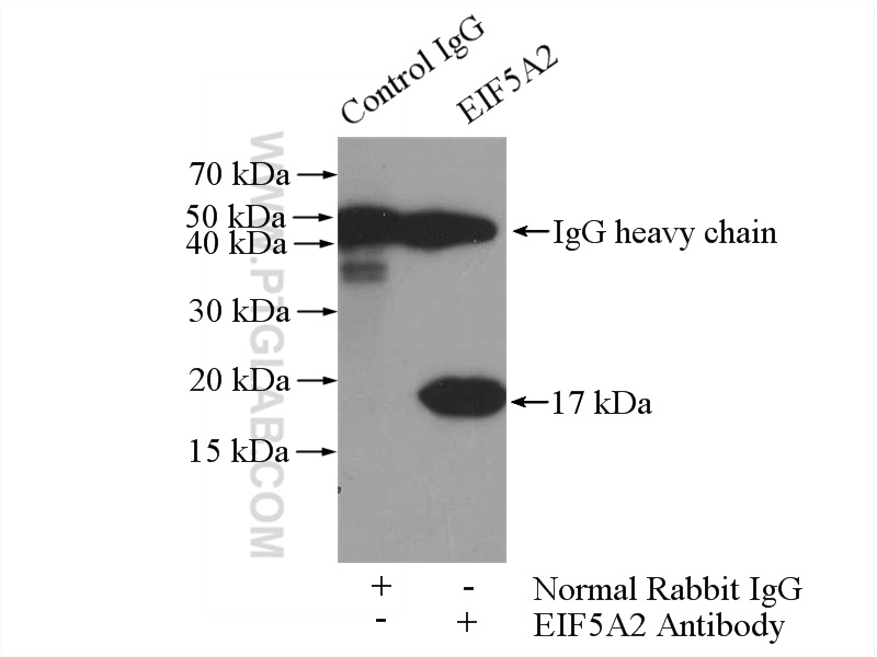 IP experiment of mouse brain using 17069-1-AP