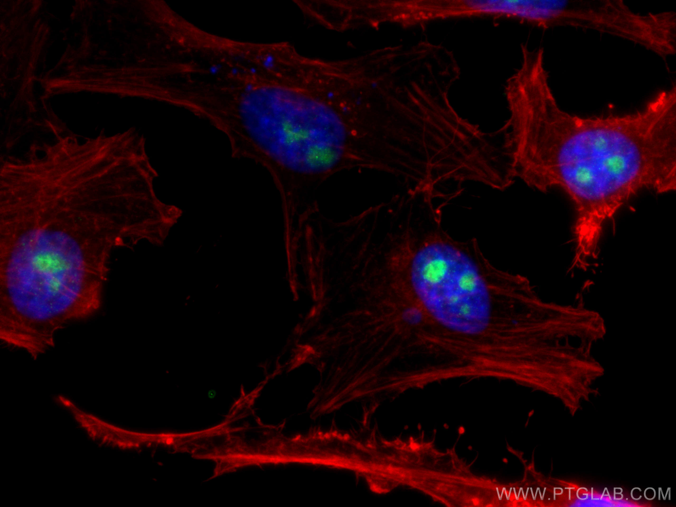 IF Staining of HeLa using 10291-1-AP