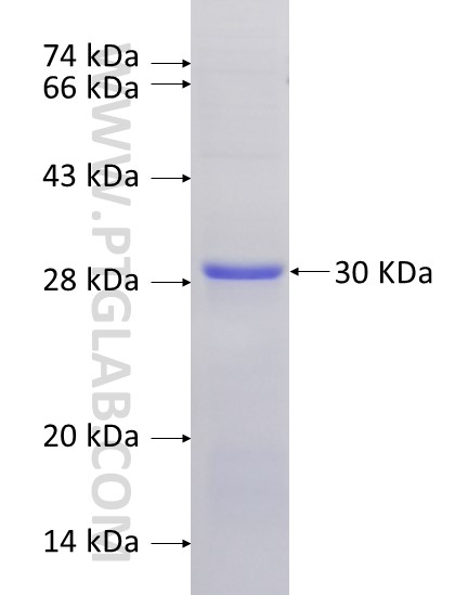 ELA3A fusion protein Ag8648 SDS-PAGE