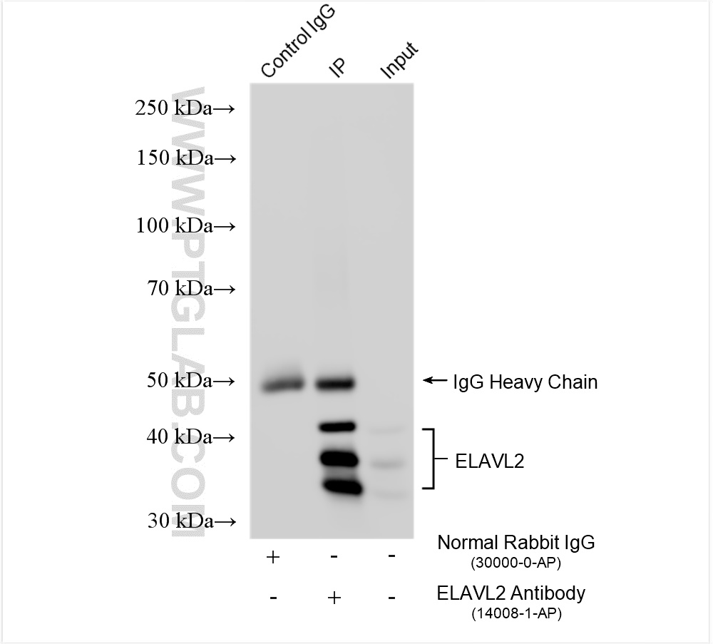 IP experiment of mouse cerebellum using 14008-1-AP