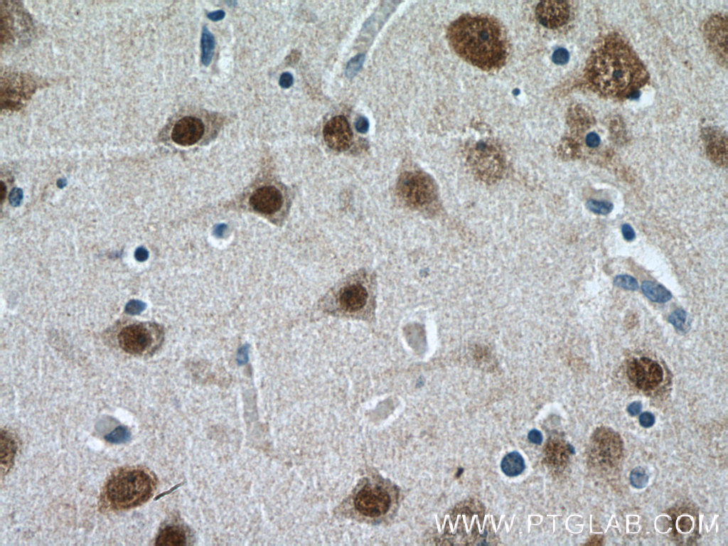 IHC staining of human brain using 13032-1-AP