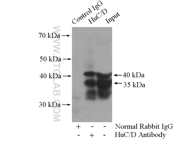 IP experiment of mouse brain using 13032-1-AP