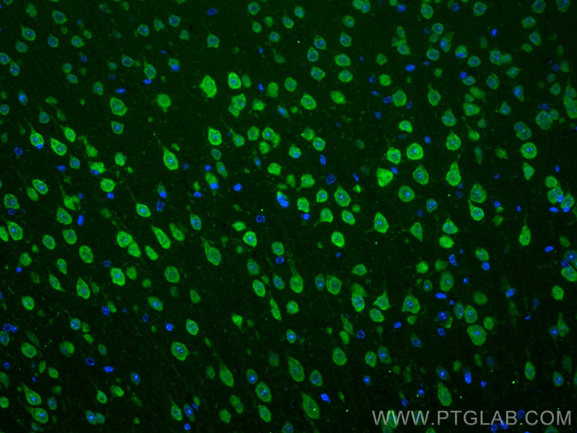IF Staining of mouse brain using 24992-1-AP