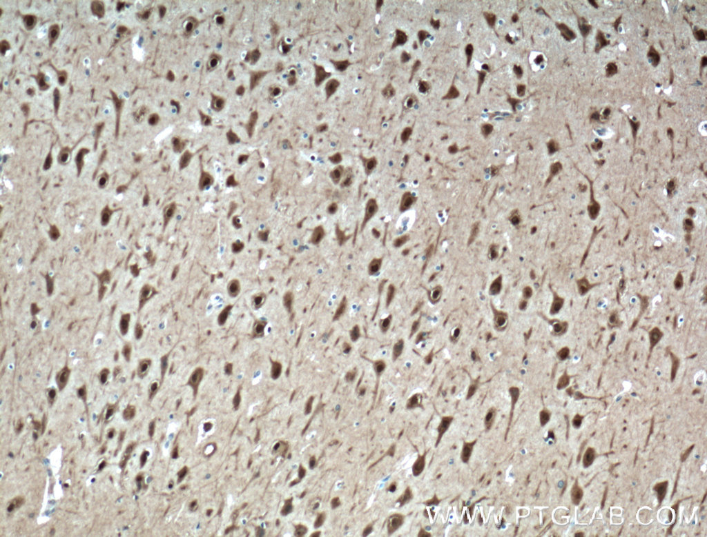 IHC staining of human brain using 24992-1-AP