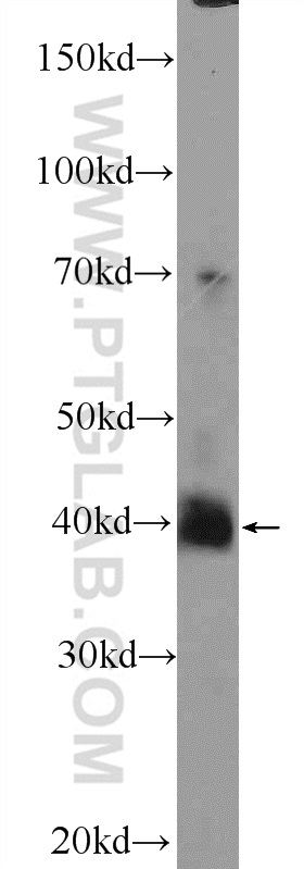 WB analysis of mouse brain using 24992-1-AP