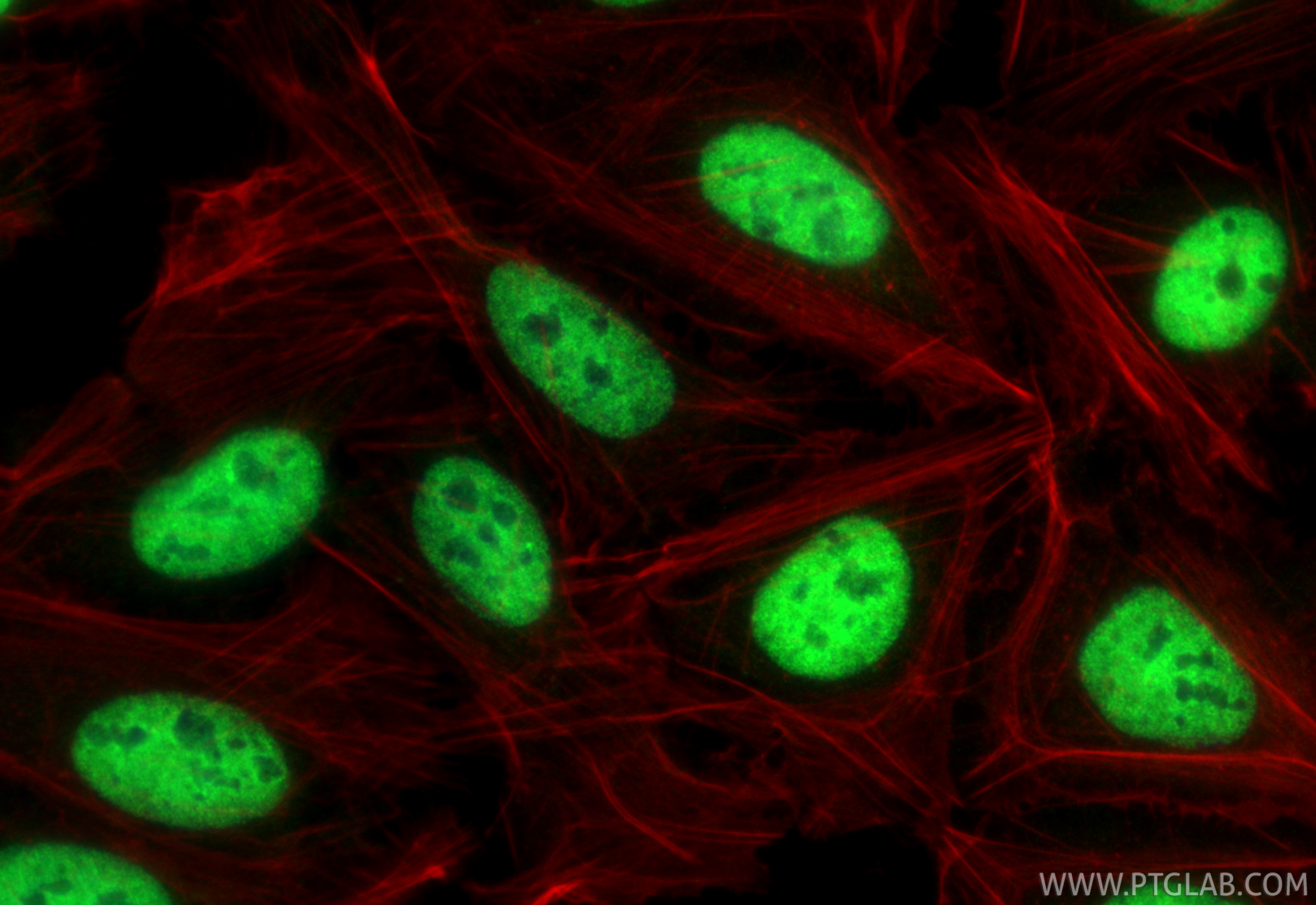IF Staining of U2OS using 67835-1-Ig IF Staining of U2OS using 67835-1-Ig