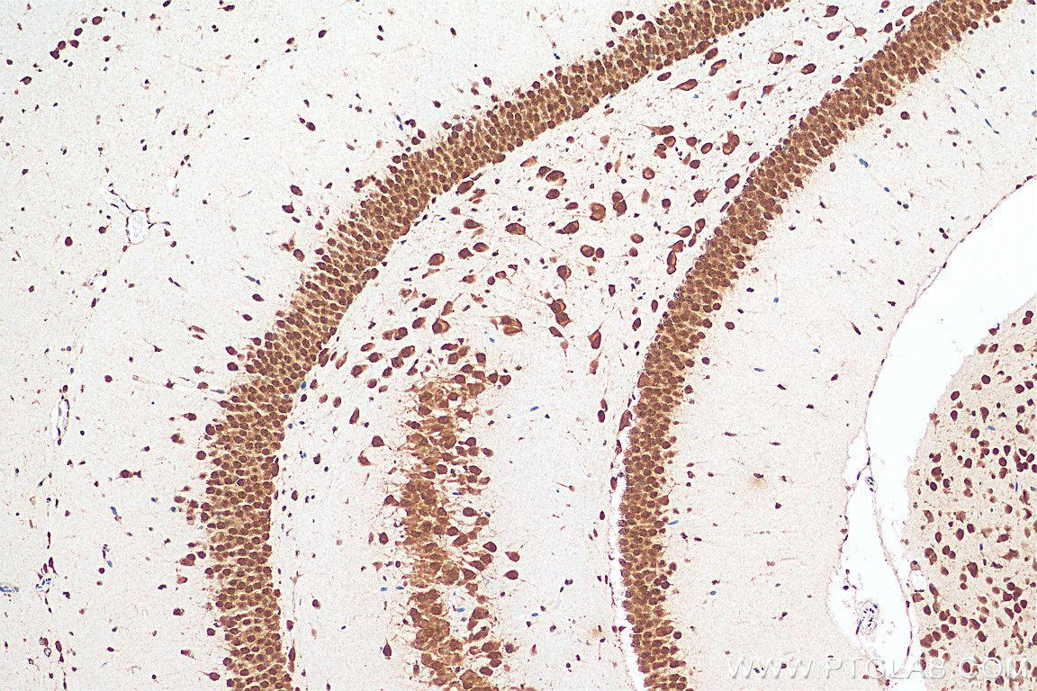 IHC staining of mouse brain using 67835-1-Ig (same clone as 67835-1-PBS)