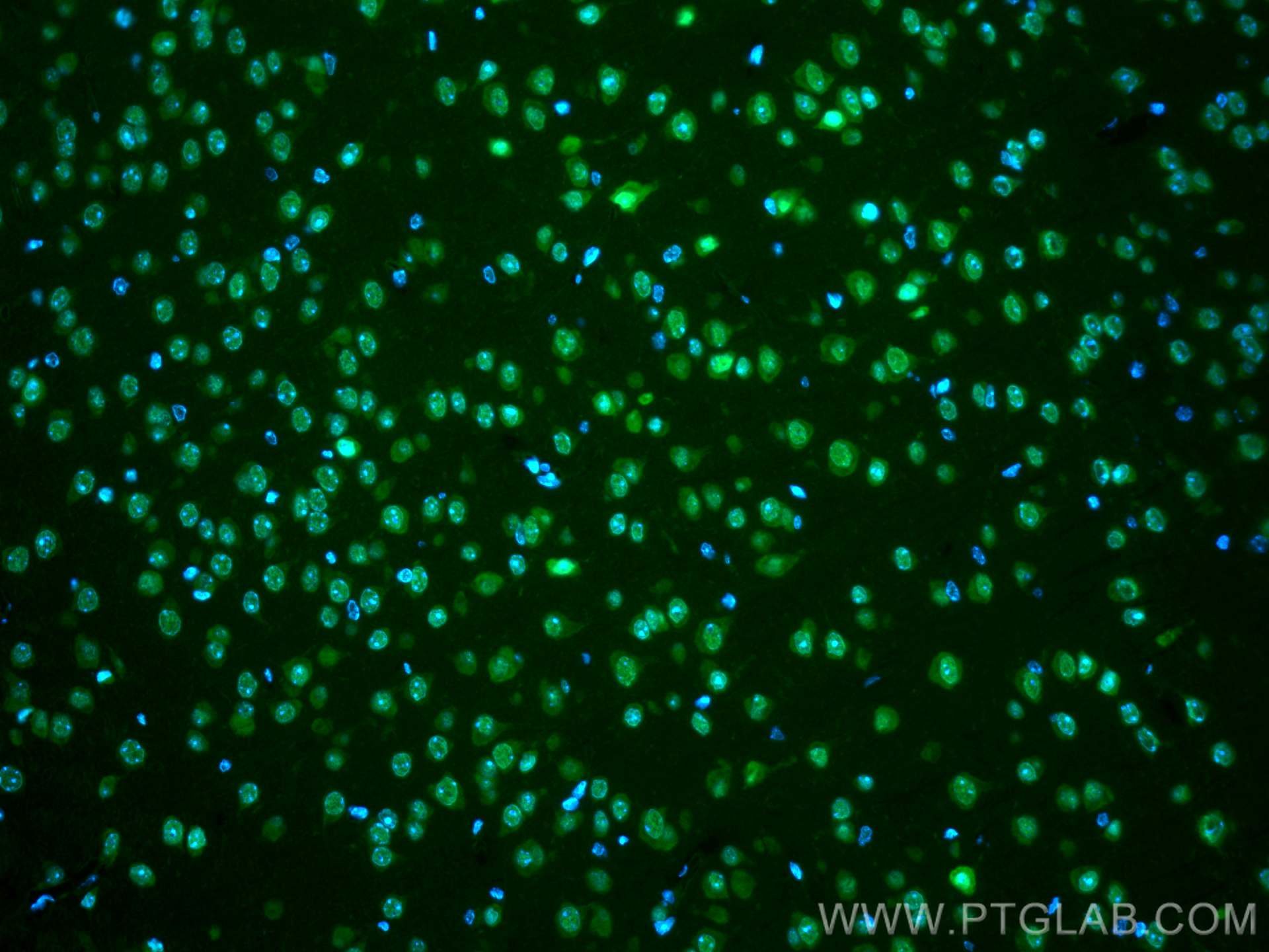 IF Staining of mouse brain using CL488-67835