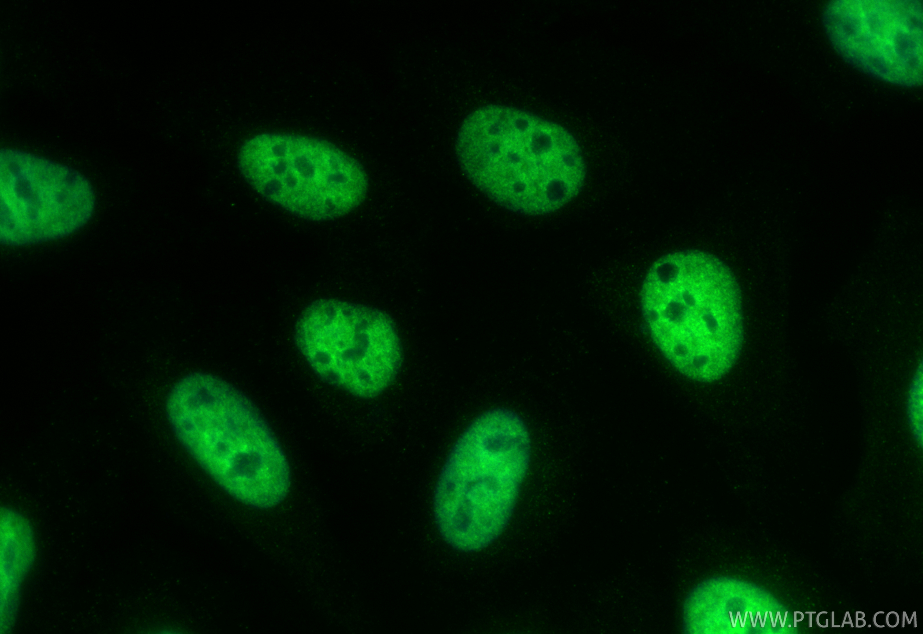 IF Staining of U2OS using CL488-67835 IF Staining of U2OS using CL488-67835