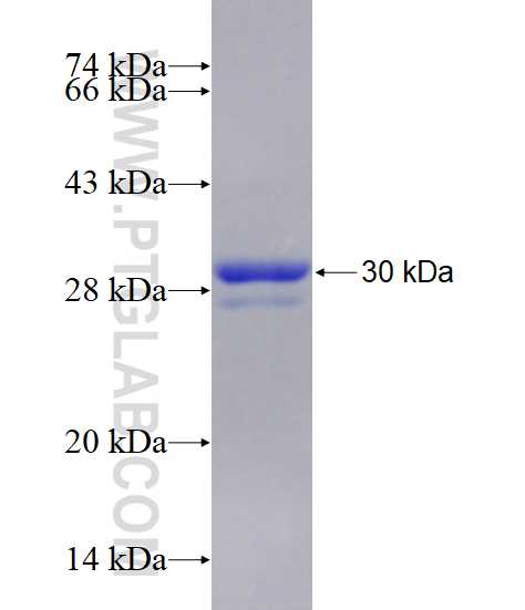ELAVL4 fusion protein Ag21830 SDS-PAGE