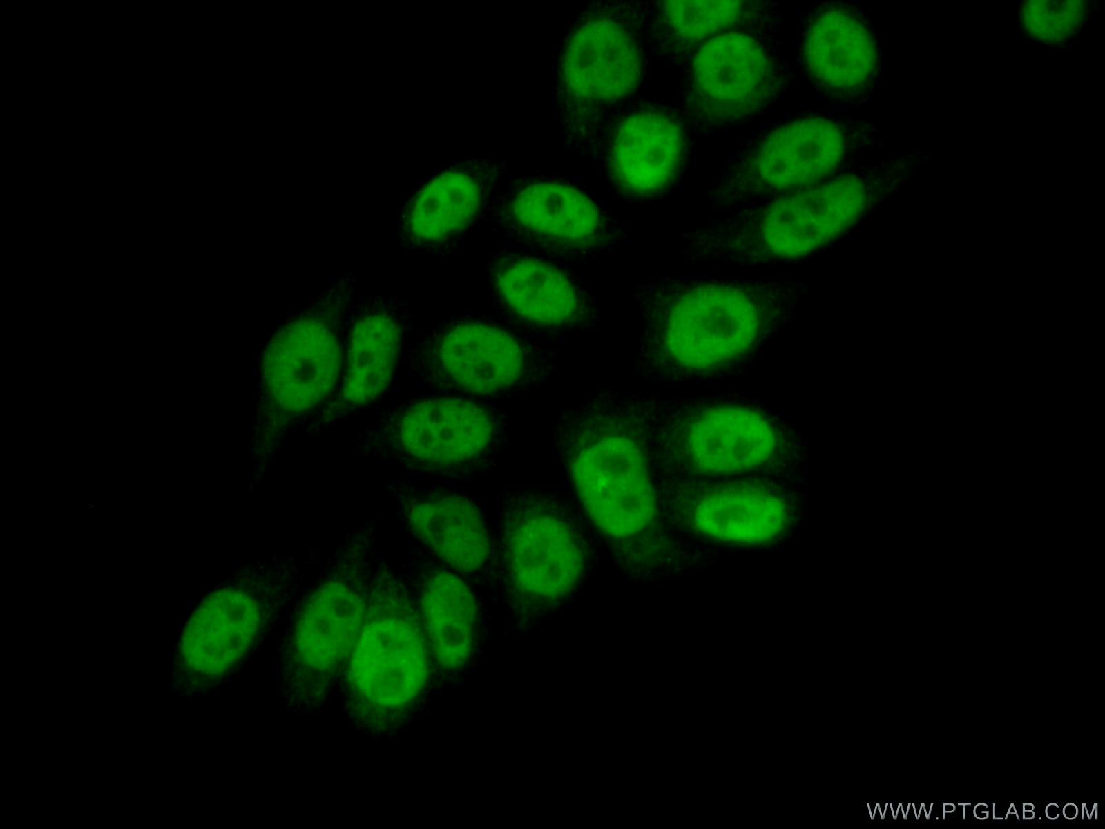 IF Staining of PC-3 using 22565-1-AP